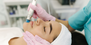 Microdermoabrasione per una pelle luminosa