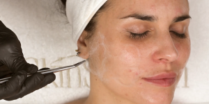 Protocollo viso antietà: fili e reticolo di collagene