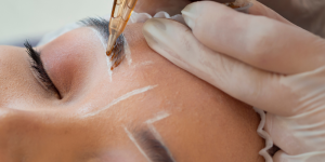 dermopigmentazione: quali sono le fasi post trattamento?