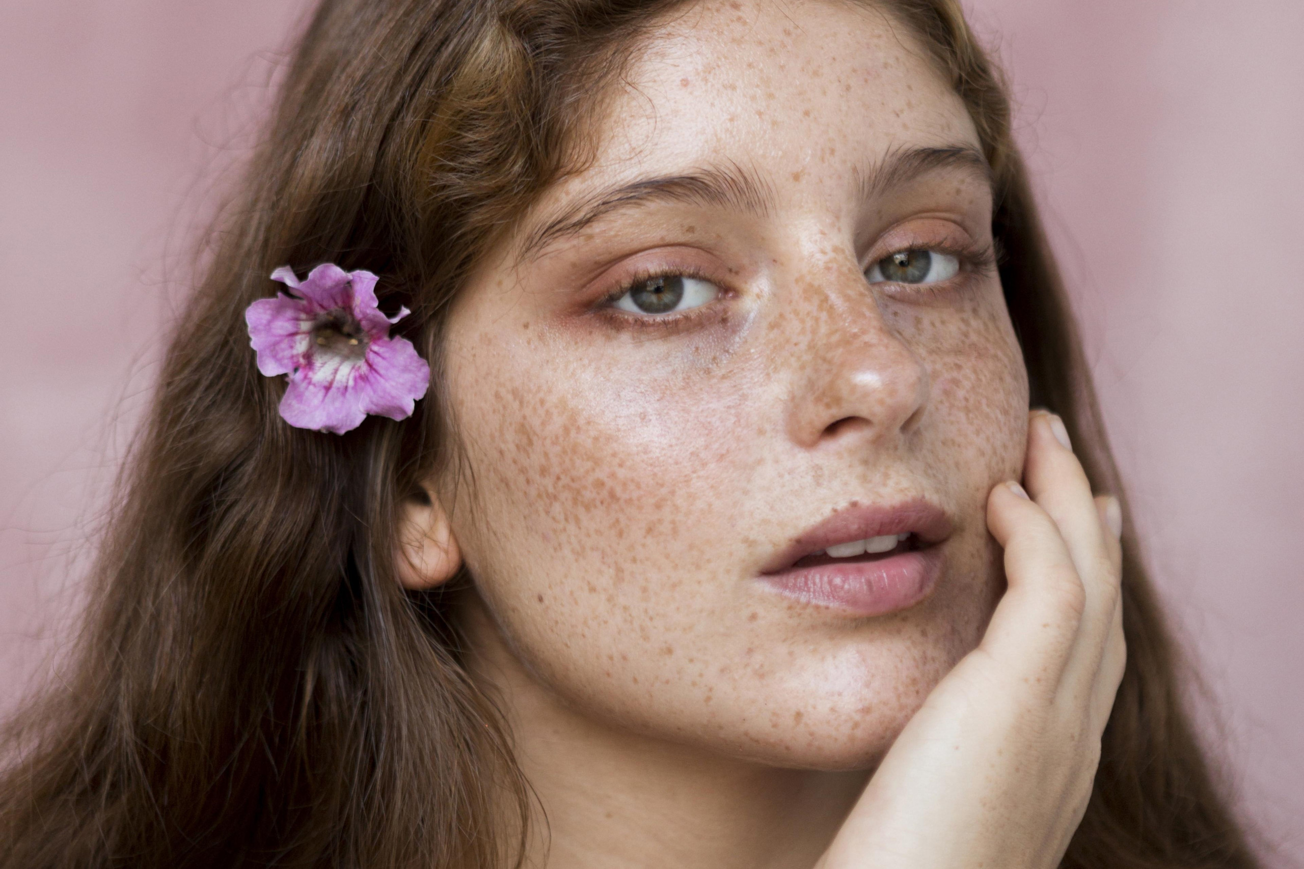 Lentiggini con henné nuovo trend beauty